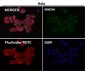 Anti-ALDH2 Monoclonal Antibody